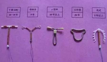 元宫型CU365节育环上环视频，一个真实到让你手心出汗的全程记录